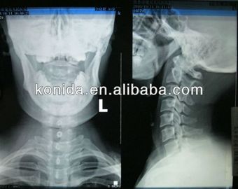 Good price Proyección de imagen de diagnóstico médica de la alta agudeza, película seca de AGFA X Ray en línea