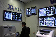 Película de X Ray de Digitaces de la transparencia, proyección de imagen médica AGFA/película seca de Fuji X Ray