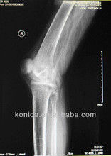 Good price Proyección de imagen de diagnóstico durable de X Ray, película azul de X Ray del laser del papel médico de los 32cm de los x 43cm en línea