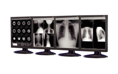 exhibiciones Anti-reflexivas del grado médico usadas en el equipo de la proyección de imagen médica