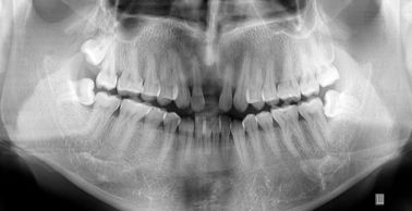 Good price Película de diagnóstico médica impermeable de la proyección de imagen X Ray de la aduana para la impresora térmica en línea