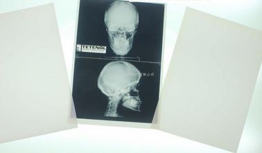 Good price proyección de imagen de diagnóstico médica de 11 x 14 lasers para la impresora laser de Konida en línea