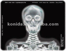Good price Película para impresoras térmicas médicas de rayos X KND-F25*30cm en línea