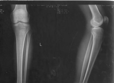 Good price película médica de la proyección de imagen del laser del papel de la radiografía de los 32cm * de los 43cm para KND-DRYTEC-4000 KND-K en línea