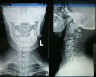 Good price Papel usable de la radiografía de la proyección de imagen médica de Konida de la alta agudeza para la impresora laser en línea