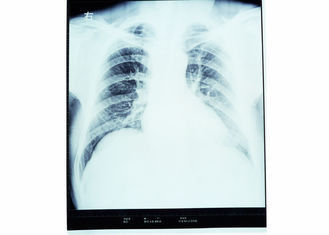 Good price Película seca de la proyección de imagen de Konida, película médica de la proyección de imagen del laser del papel en línea