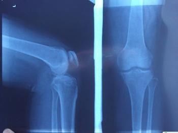 Proyección de imagen de diagnóstico azul de X Ray, película fotográfica del laser de la radiografía médica del papel