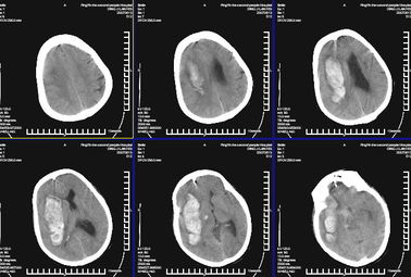 Good price Proyección de imagen de diagnóstico médica impermeable KND-K de X Ray para la impresora laser de Konida en línea