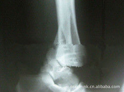 Good price Proyección de imagen médica del laser X Ray del Libro Blanco prenda impermeable de los 8in del x 10in en línea