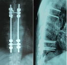 X azul seco de la película de la proyección de imagen médica de Ray 8 x 10 pulgadas para Agfa/Fuji