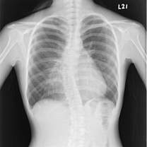 Good price Pulgada seca médica baja blanca X12 de la película 10 del laser X Ray degradable en línea