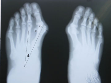 Proyección de imagen impermeable del diagnóstico de X Ray