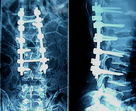 Good price Película seca médica de la proyección de imagen de la niebla baja de Konida para el examen de X Ray en línea