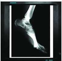 Good price proyección de imagen de diagnóstico médica de los 20cm de los x 25cm, papel de la película X Ray de la impresora laser en línea