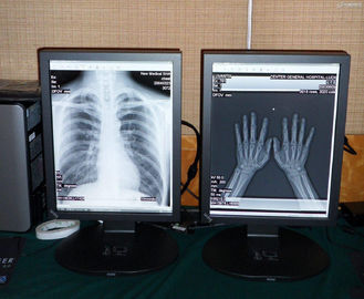 Good price exhibición médica del color de alta calidad médico 2MP en línea