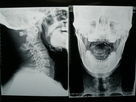 Película de alta densidad X Ray de la proyección de imagen médica seco para Fuji 3000/2000/1000