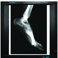película seca para médico, CE/SFDA/ISO 13485 del rayo de X de Digitaces del agfa