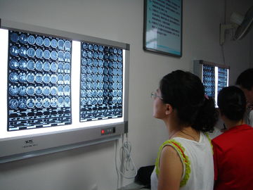 Película seca médica seca el 10in el x 12in de X Ray del laser para las impresoras de Fuji