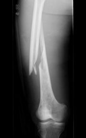 Proyección de imagen médica del laser X Ray de Konida