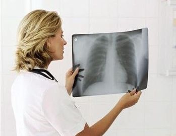 Good price los 20cm los x 25cm X Ray Diagnostic Imaging en línea
