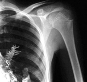 Good price Película de Fuji X Ray de la impresora térmica de Konida, película de Agfa Drystar Dt2b en línea