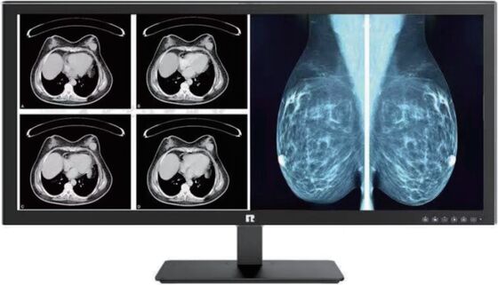 Buen precio Display médico de alta definición con cumplimiento DICOM para imágenes de grado radiológico en línea