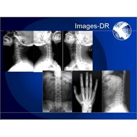 Good price Máquina de la radiografía de Digitaces de la RADIOGRAFÍA de Mammogrpahy con el brazo flexible del UC en línea