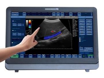 Portable médico del sistema del ultrasonido de Doppler del color 3D/4D con el monitor de 15 pulgadas LED