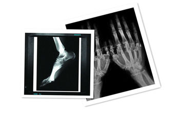 Blanco médico de la película del CT de la pulgada ×10 de la prenda impermeable 8 del papel de X Ray de la película del ANIMAL DOMÉSTICO de Hosipital