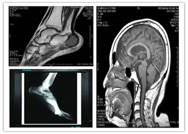 Good price Película seca baja azul médica de la proyección de imagen de Digitaces exploración compatible de 8 del x 10in Hosipital Mri en línea