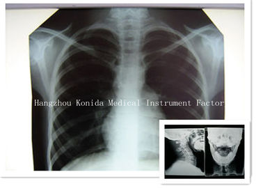 Good price Película radiográfica de X Ray de Digitaces de la película 14 x 17inch de la proyección de imagen seca médica de la salud en línea