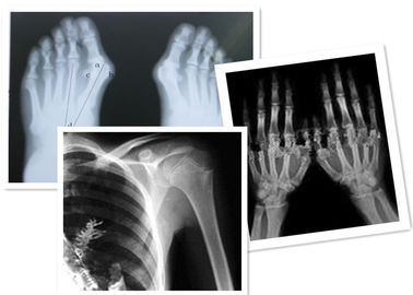 Good price Película termal Fuji de X Ray de Digitaces médico para el examen de la radiografía en línea