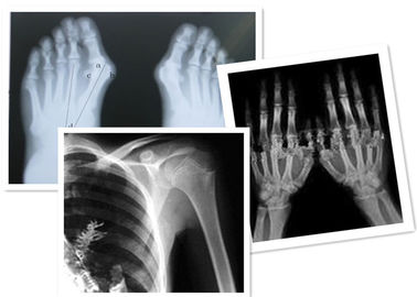 Película termal Fuji de X Ray de Digitaces médico para el examen de la radiografía