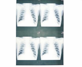 Good price Película médica baja blanca del papel de X Ray a prueba de humedad para Sony/la impresora laser de EPSON en línea