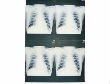 proyección de imagen de diagnóstico médica de los 20cm de los x 25cm, papel de la película X Ray de la impresora laser
