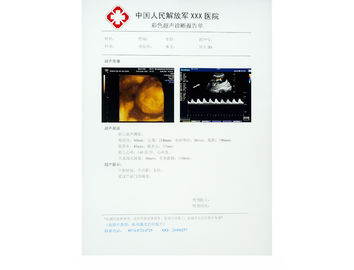 Película médica del papel resistente al rayado de la radiografía para KND-DRYTEC-3000, KND-DRYTEC-4000