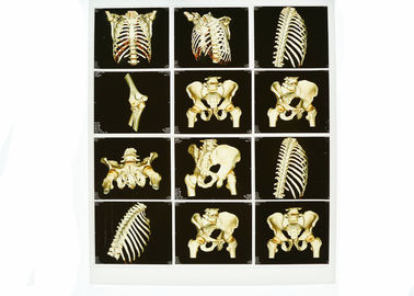 Proyección de imagen de diagnóstico blanca usable de la base X Ray, película azul médica de X Ray del laser