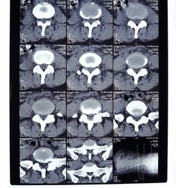 Película de X Ray de Digitaces de la transparencia, proyección de imagen médica AGFA/película seca de Fuji X Ray