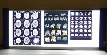 películas secas de la proyección de imagen médica de la radiografía del 10in * del 14in Digitaces para las impresoras térmicas KND-F