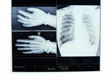Good price Proyección de imagen de resistencia del calor de alta resolución seco médico de la película de Konida en línea
