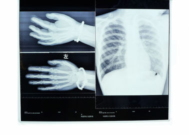 Película seca médica 14 x 17 Konida de la proyección de imagen X Ray, de alta densidad