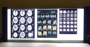 Good price Base seca médica brillante del azul del laser de la película de la impresora térmica de X Ray en línea