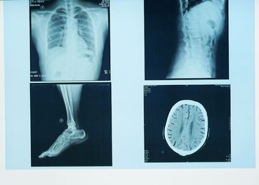Proyección de imagen de diagnóstico durable de X Ray, película azul de X Ray del laser del papel médico de los 32cm de los x 43cm