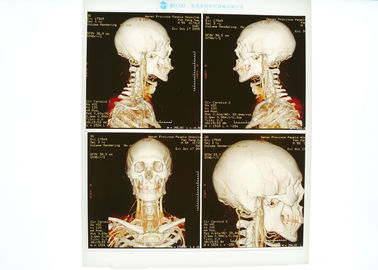 Good price Azul médico de alta densidad de la película de X Ray para la impresora laser de Konida en línea