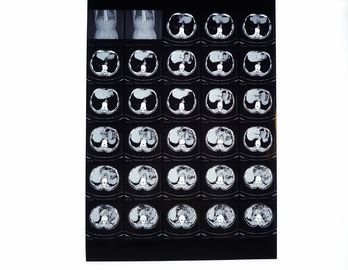 Películas médicas del rayo de X, película seca de la proyección de imagen compatible con la impresora térmica para el CT/el dr/MRI