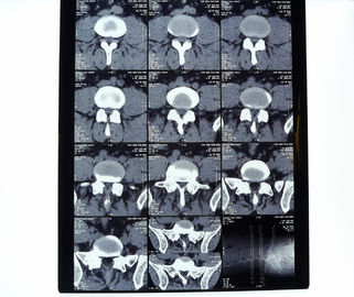 Good price 8in* el 10in película seca de la impresora térmica de la radiografía médica de alta densidad del 14in * del 17in en línea