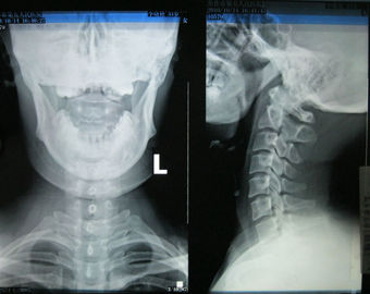 calidad película seca médica brillante de la proyección de imagen de los 35cm * de los 43cm para Fuji 3000, 2000, 1000, impresora térmica fábrica