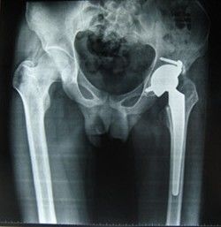 Good price Película seca médica los 28cm * los 35cm de la proyección de imagen de Konida de la niebla de la base azulada baja del poliéster para la impresora térmica en línea