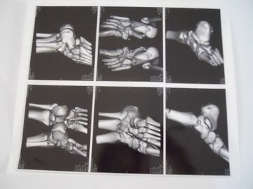 Good price Película seca médica de la proyección de imagen para el examen de X Ray en AGFA 5300, 5302, 5500 en línea