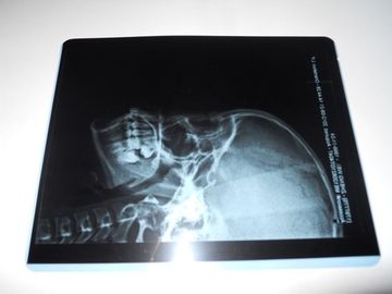 Good price Película seca médica de la proyección de imagen de la alta agudeza de KND-A Konida para la impresora térmica en línea